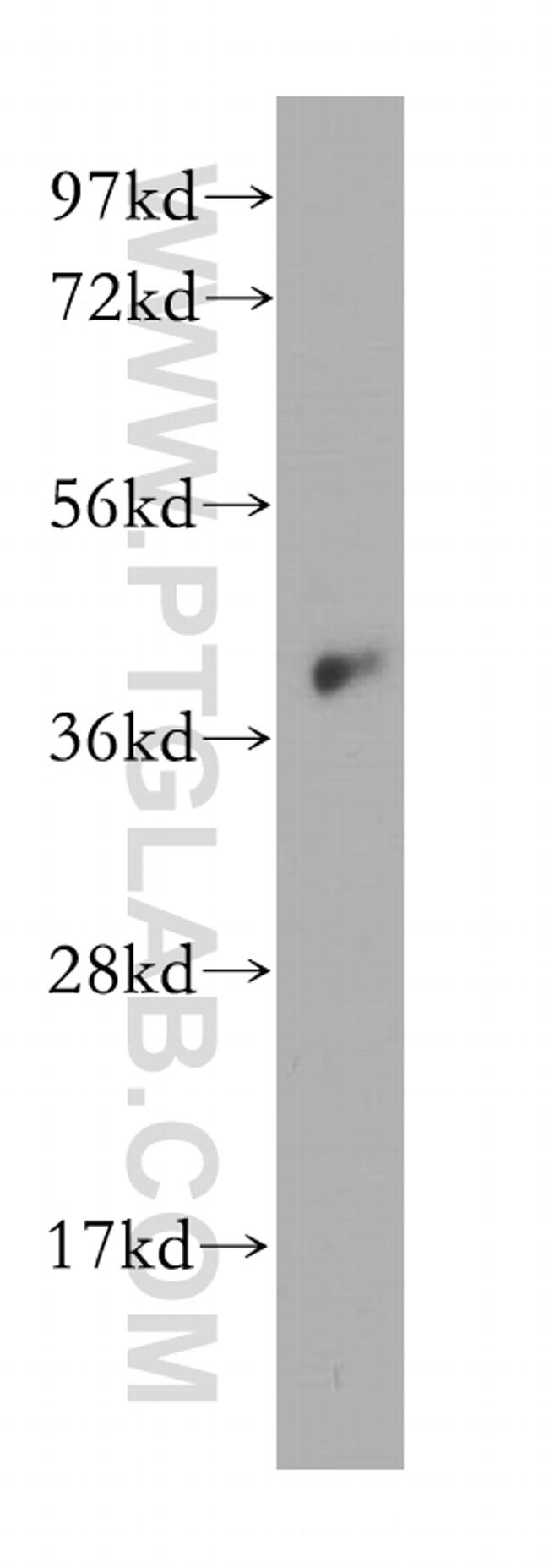 IGBP1 Antibody in Western Blot (WB)