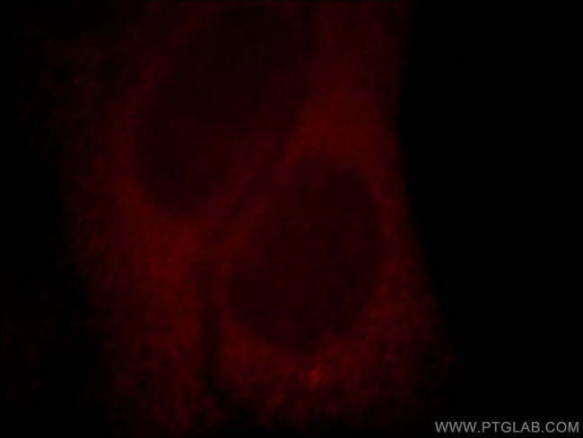 Kir6.1 Antibody in Immunocytochemistry (ICC/IF)