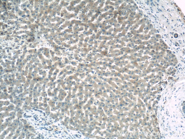 OAS1 Antibody in Immunohistochemistry (Paraffin) (IHC (P))