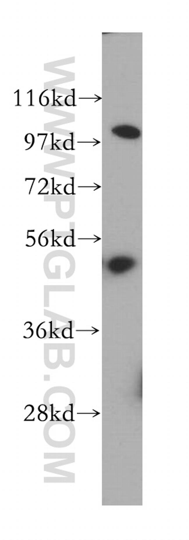 OAS1 Antibody in Western Blot (WB)