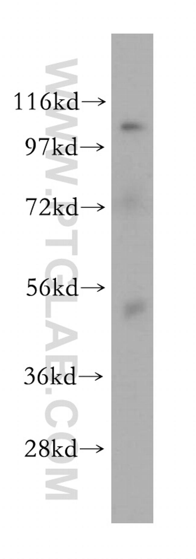 OAS1 Antibody in Western Blot (WB)