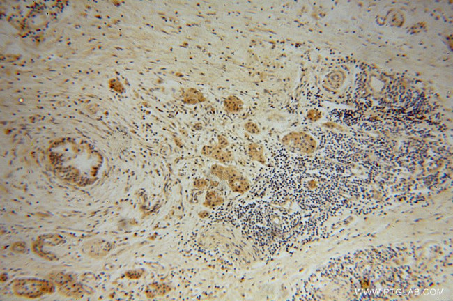 BEGAIN Antibody in Immunohistochemistry (Paraffin) (IHC (P))