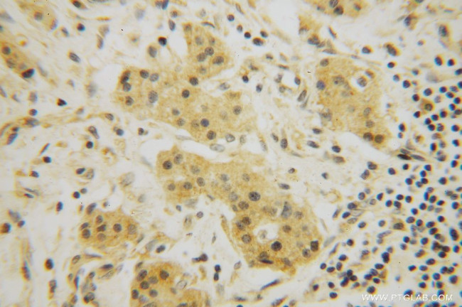 BEGAIN Antibody in Immunohistochemistry (Paraffin) (IHC (P))