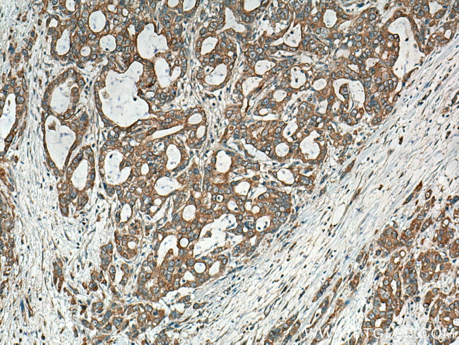 BEGAIN Antibody in Immunohistochemistry (Paraffin) (IHC (P))