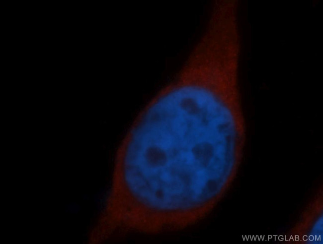 RPS15 Antibody in Immunocytochemistry (ICC/IF)