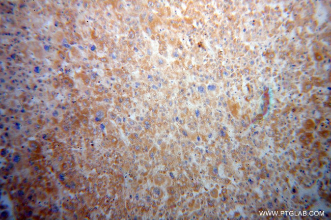 RPS15 Antibody in Immunohistochemistry (Paraffin) (IHC (P))