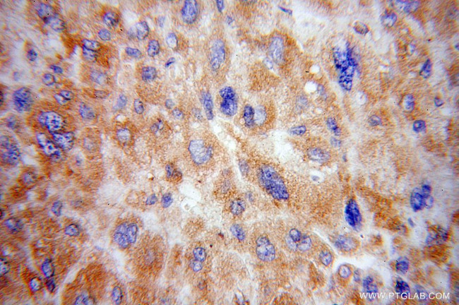 RPS15 Antibody in Immunohistochemistry (Paraffin) (IHC (P))