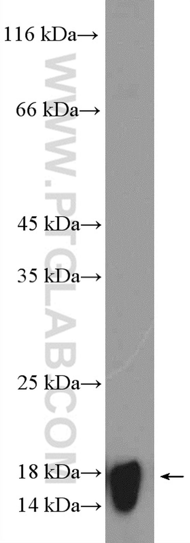 RPS15 Antibody in Western Blot (WB)