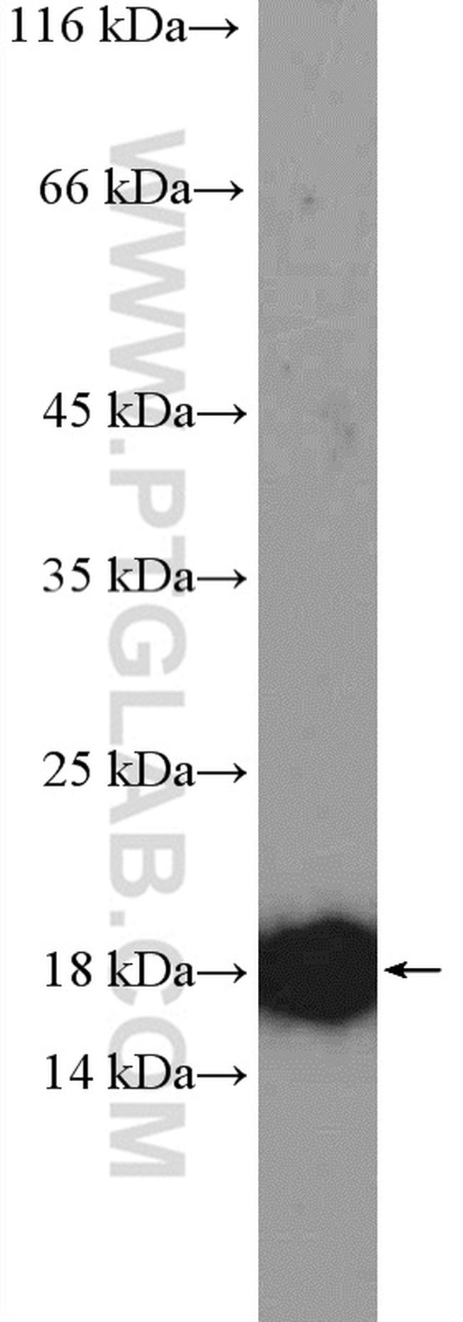 RPS15 Antibody in Western Blot (WB)