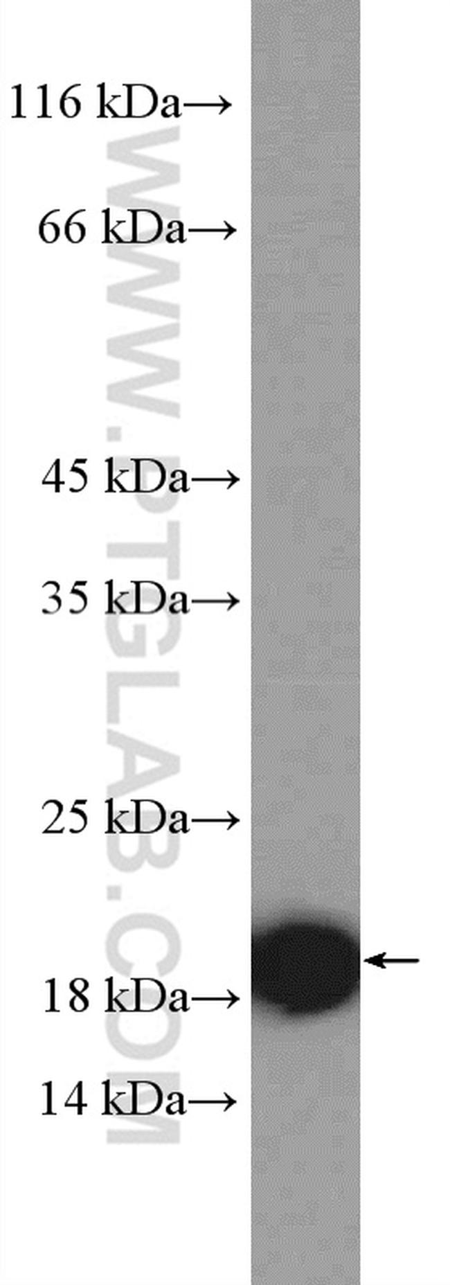 RPS15 Antibody in Western Blot (WB)