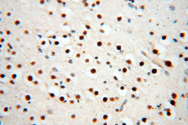 RBM8A/Y14 Antibody in Immunohistochemistry (Paraffin) (IHC (P))