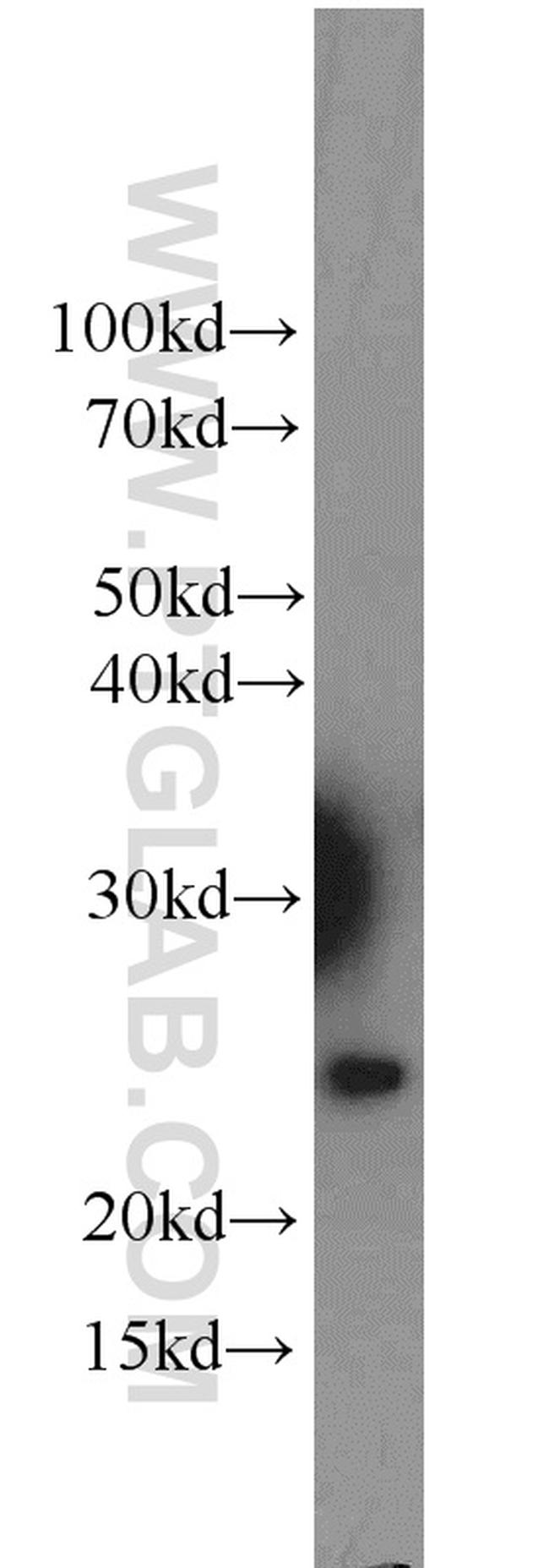 RBM8A/Y14 Antibody in Western Blot (WB)