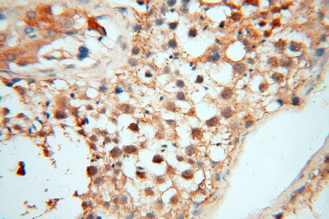 RBM8A/Y14 Antibody in Immunohistochemistry (Paraffin) (IHC (P))