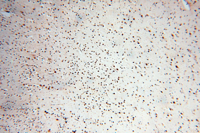 RBM8A/Y14 Antibody in Immunohistochemistry (Paraffin) (IHC (P))