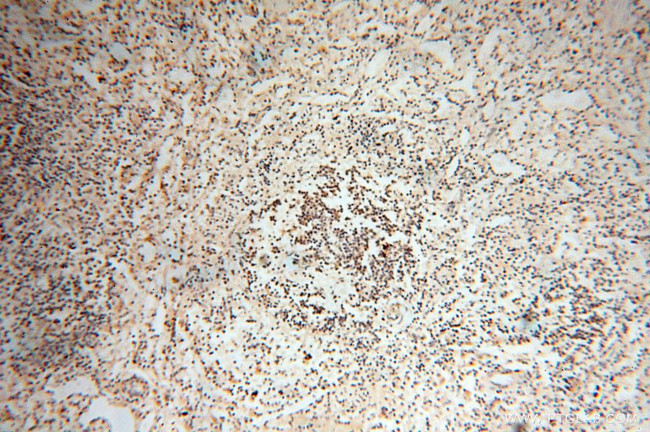 RBM8A/Y14 Antibody in Immunohistochemistry (Paraffin) (IHC (P))