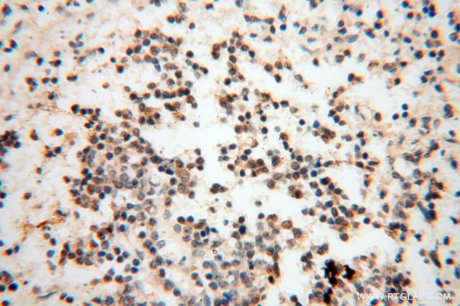 RBM8A/Y14 Antibody in Immunohistochemistry (Paraffin) (IHC (P))