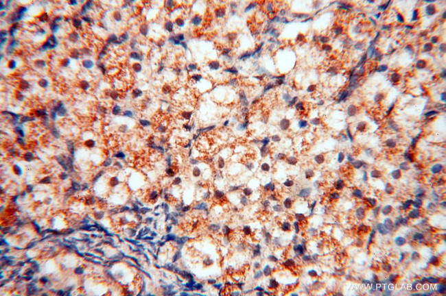 RBM8A/Y14 Antibody in Immunohistochemistry (Paraffin) (IHC (P))