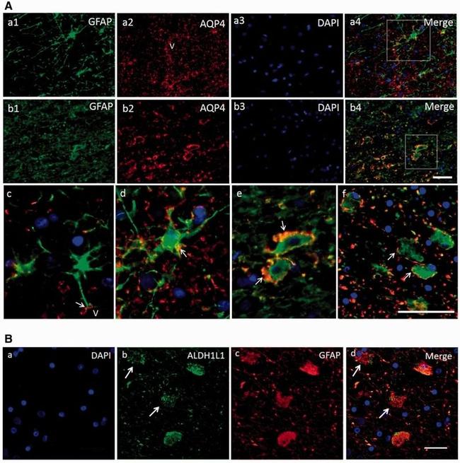 ALDH1L1 Antibody in Immunohistochemistry (IHC)