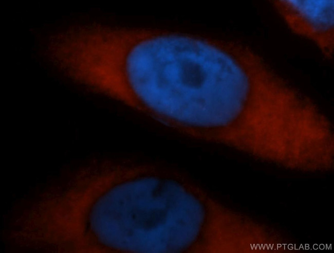 PABPC4 Antibody in Immunocytochemistry (ICC/IF)