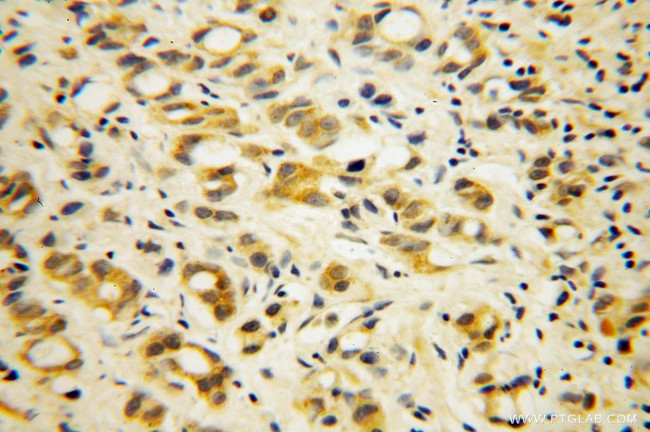 PABPC4 Antibody in Immunohistochemistry (Paraffin) (IHC (P))