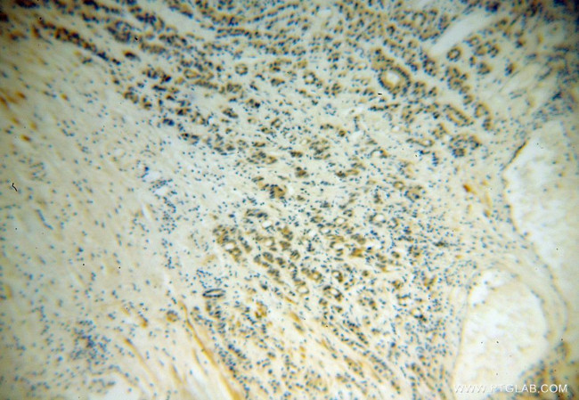 PABPC4 Antibody in Immunohistochemistry (Paraffin) (IHC (P))