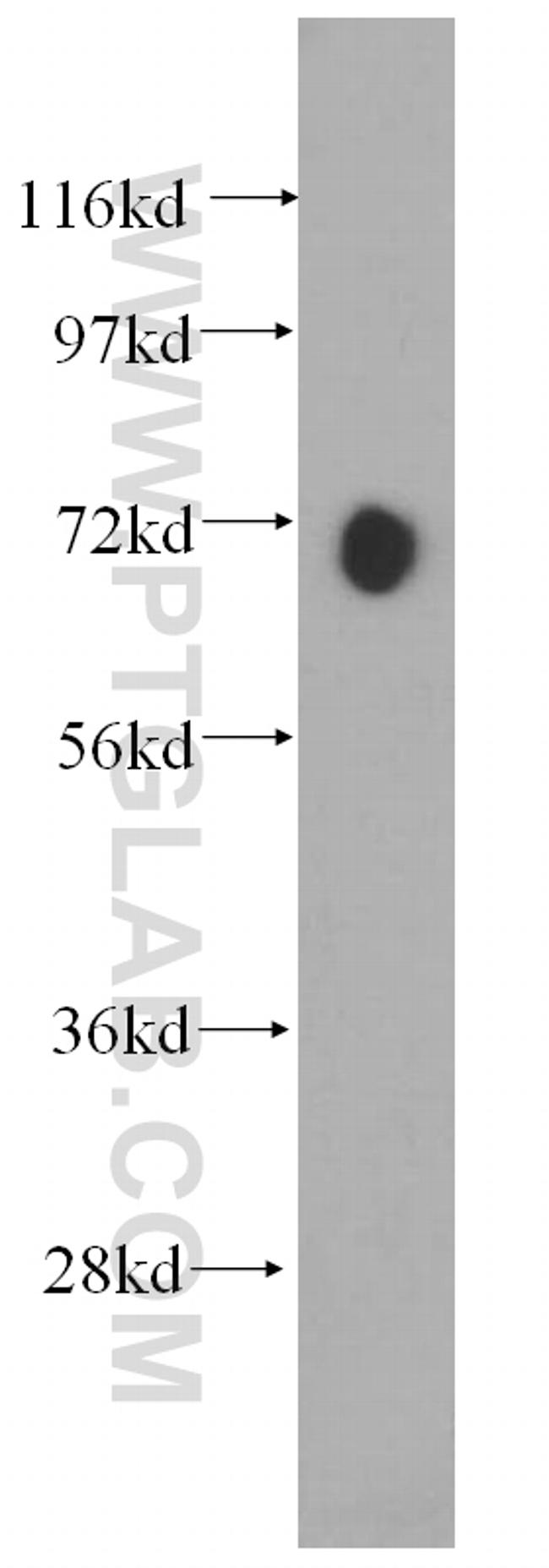 PABPC4 Antibody in Western Blot (WB)