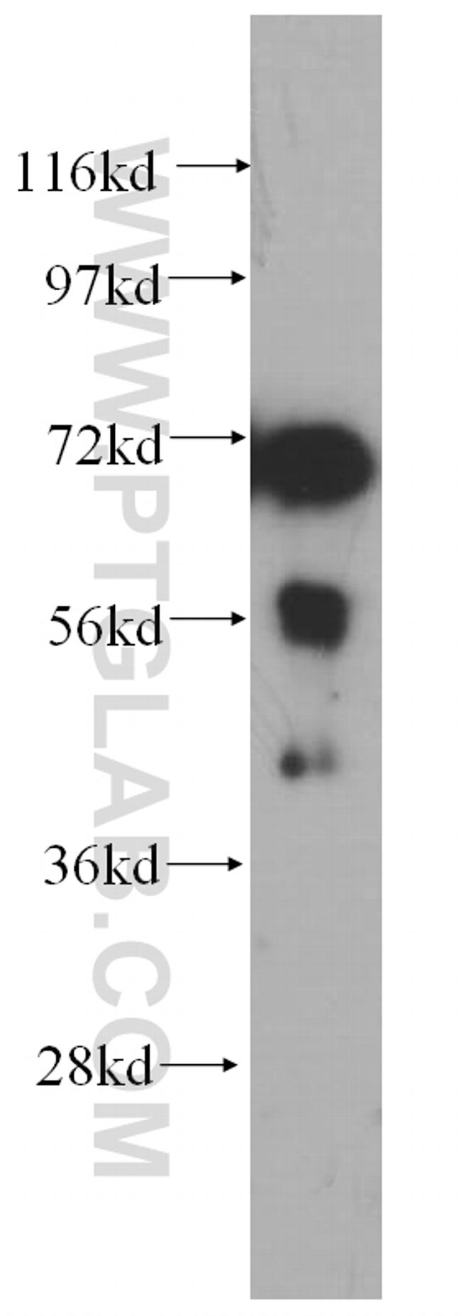 PABPC4 Antibody in Western Blot (WB)