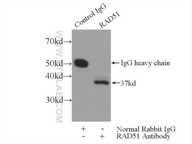 RAD51 Antibody in Immunoprecipitation (IP)