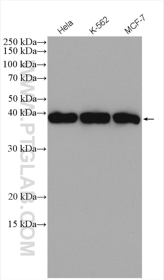 RAD51 Antibody in Western Blot (WB)