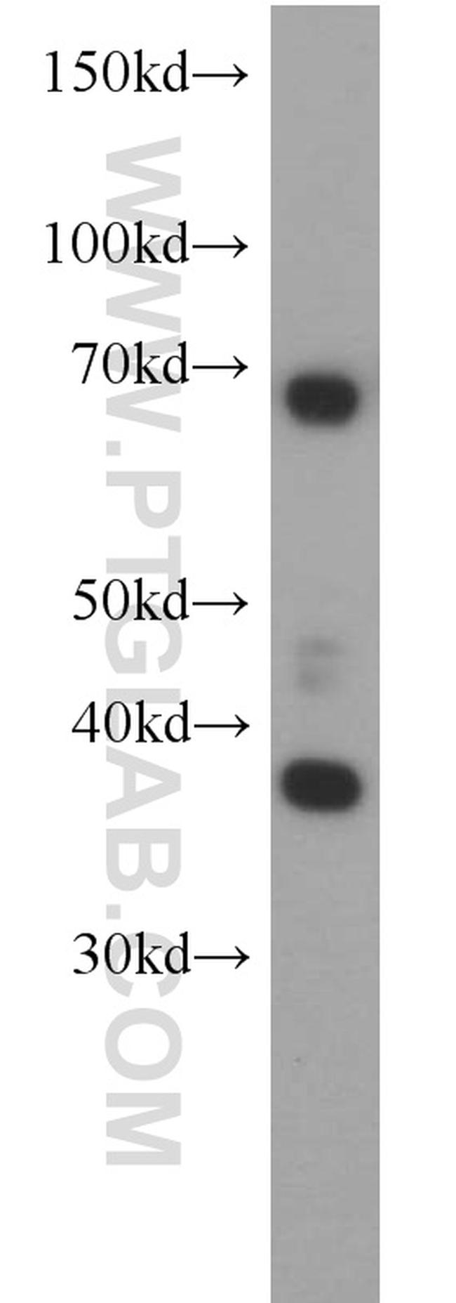 RAD51 Antibody in Western Blot (WB)