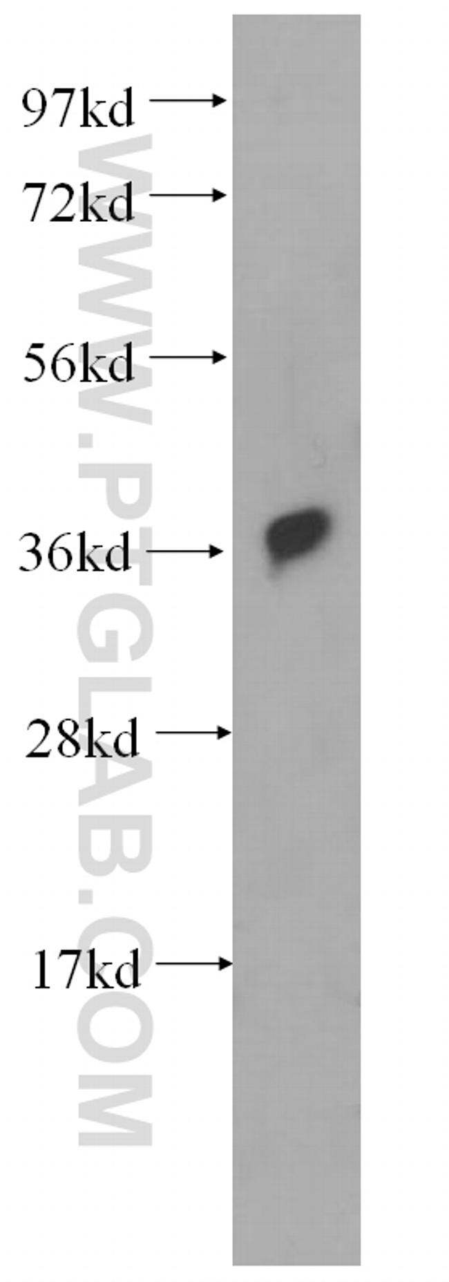 RAD51 Antibody in Western Blot (WB)