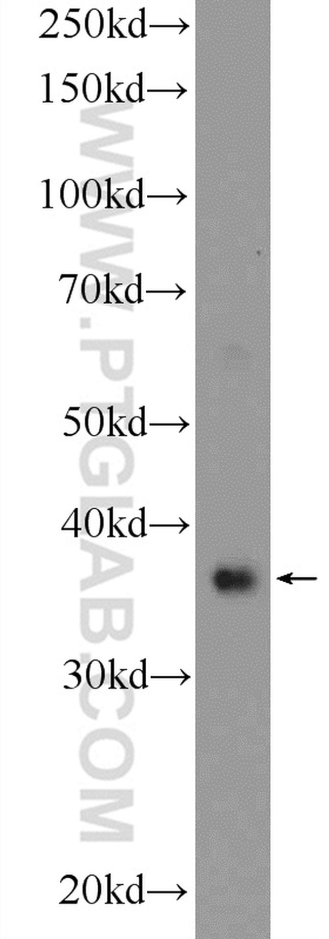 RAD51 Antibody in Western Blot (WB)