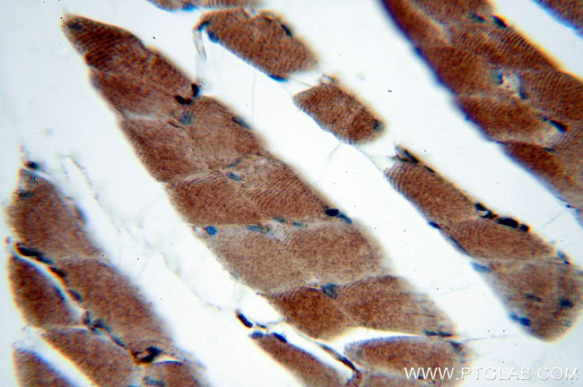 SERPINB6 Antibody in Immunohistochemistry (Paraffin) (IHC (P))