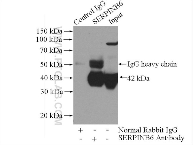 SERPINB6 Antibody in Immunoprecipitation (IP)