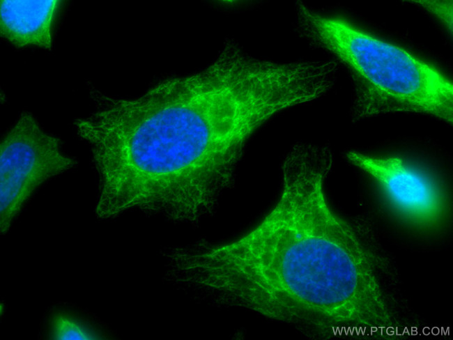 Cytokeratin 19 Antibody in Immunocytochemistry (ICC/IF)