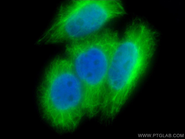 Cytokeratin 19 Antibody in Immunocytochemistry (ICC/IF)