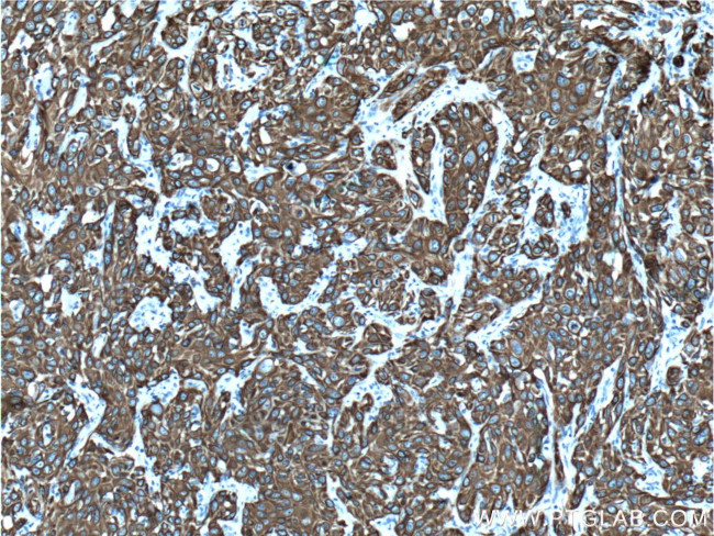 Cytokeratin 19 Antibody in Immunohistochemistry (Paraffin) (IHC (P))