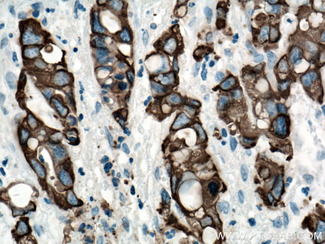 Cytokeratin 19 Antibody in Immunohistochemistry (Paraffin) (IHC (P))