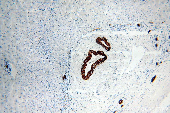 Cytokeratin 19 Antibody in Immunohistochemistry (Paraffin) (IHC (P))