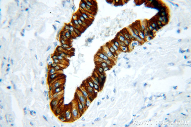 Cytokeratin 19 Antibody in Immunohistochemistry (Paraffin) (IHC (P))