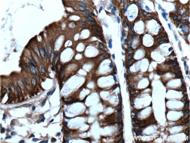 Cytokeratin 19 Antibody in Immunohistochemistry (Paraffin) (IHC (P))