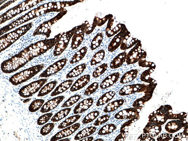 Cytokeratin 19 Antibody in Immunohistochemistry (Paraffin) (IHC (P))