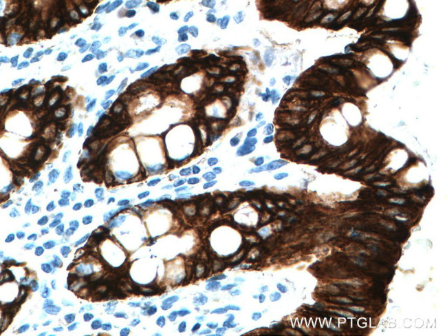 Cytokeratin 19 Antibody in Immunohistochemistry (Paraffin) (IHC (P))