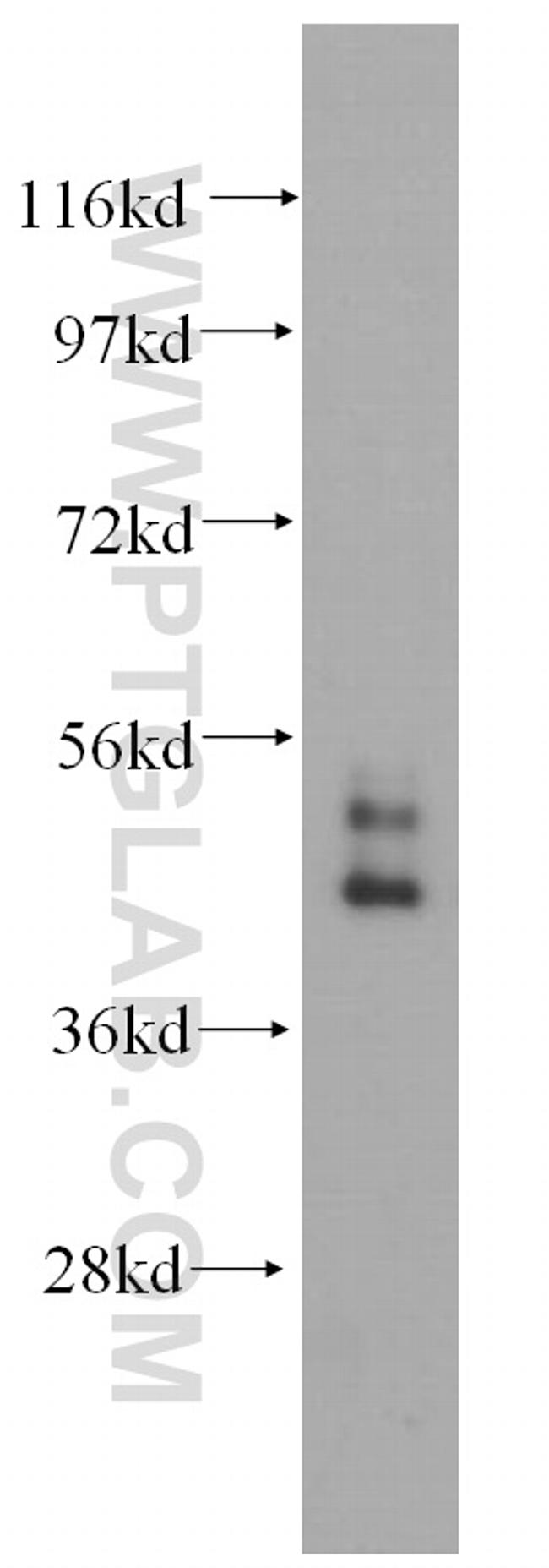 Cytokeratin 19 Antibody in Western Blot (WB)