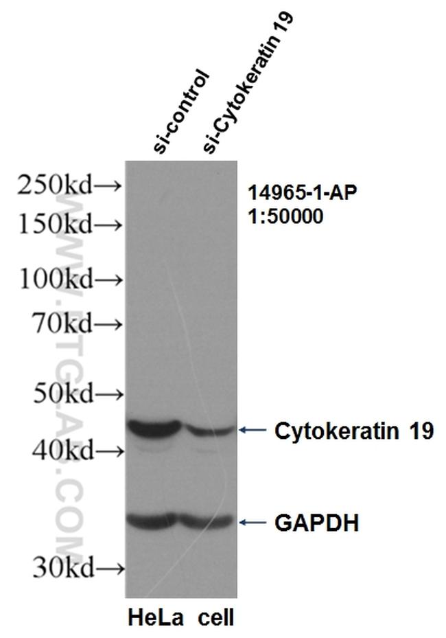 Cytokeratin 19 Antibody in Western Blot (WB)