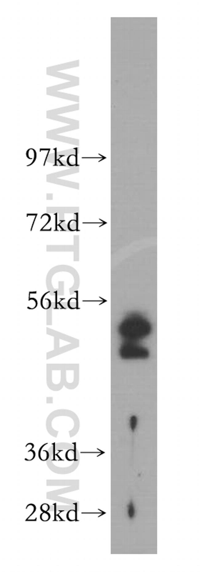 Cytokeratin 19 Antibody in Western Blot (WB)