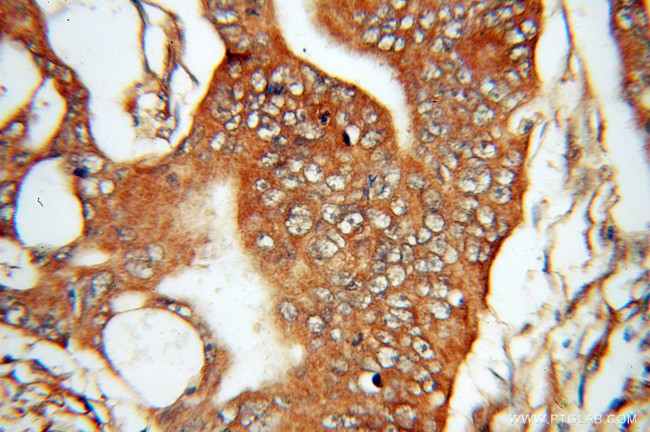 DDAH2 Antibody in Immunohistochemistry (Paraffin) (IHC (P))