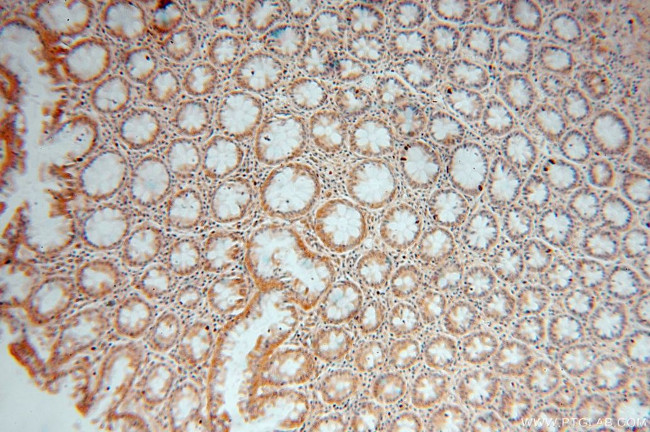 DDAH2 Antibody in Immunohistochemistry (Paraffin) (IHC (P))