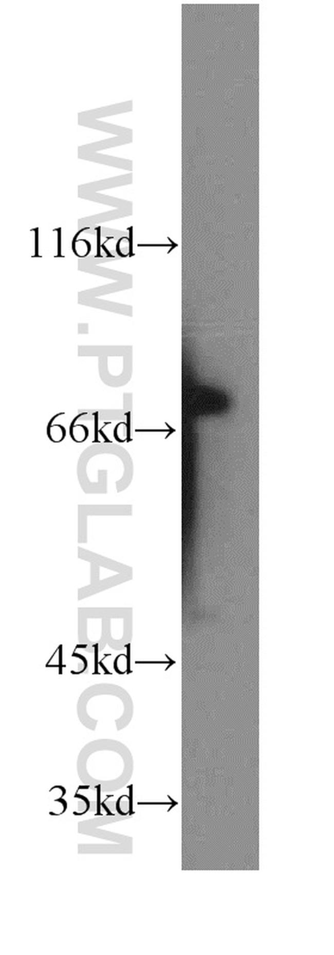 KATNB1 Antibody in Western Blot (WB)