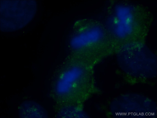 KATNB1 Antibody in Immunocytochemistry (ICC/IF)